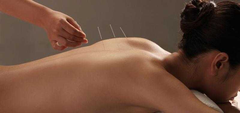 Acupuncture for Health