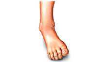 Ankle Instability Treatment at Foot Clinic, London