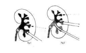 Best Infertility Center in Bangalore  Infertility specialist in Bangalore  IVF in Bangalore