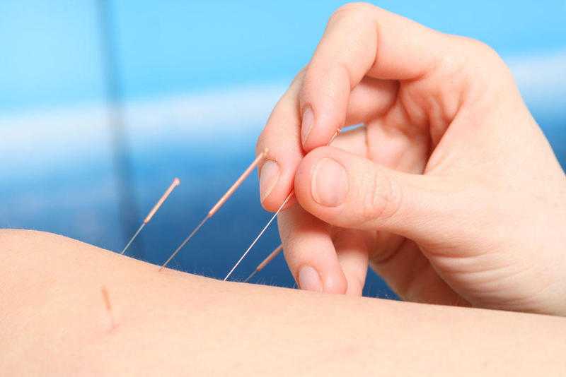 Chinese Medicine amp Massage Clinic in North-East London (Debden)