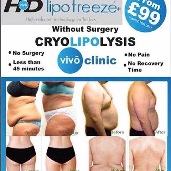 Cryo Lipo Treatment (FAT FREEZE)  VIVO Cheshire Clinic