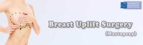 Find Breast Uplift Surgery Experts in UK - Cosmetic Surgery Partners