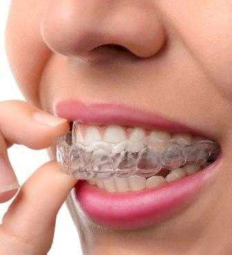 Find Tooth Whitening Services In Shrewsbury amp Shropshire