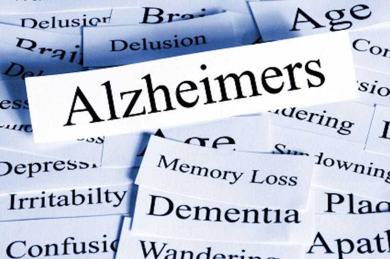 Free Alzheimer039s and Dementia Drop in Sessions