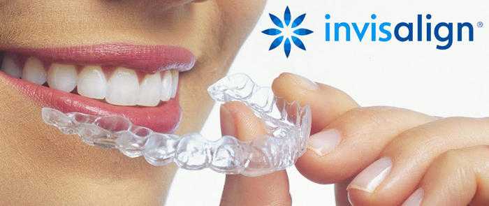 Free Invisalign Consultation Stratford