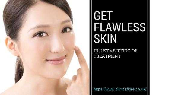 Get flawless skin in just 4 sitting of treatment