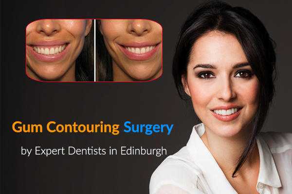 Gum Contouring and Reshaping Surgery by Expert Dentists in Edinburgh