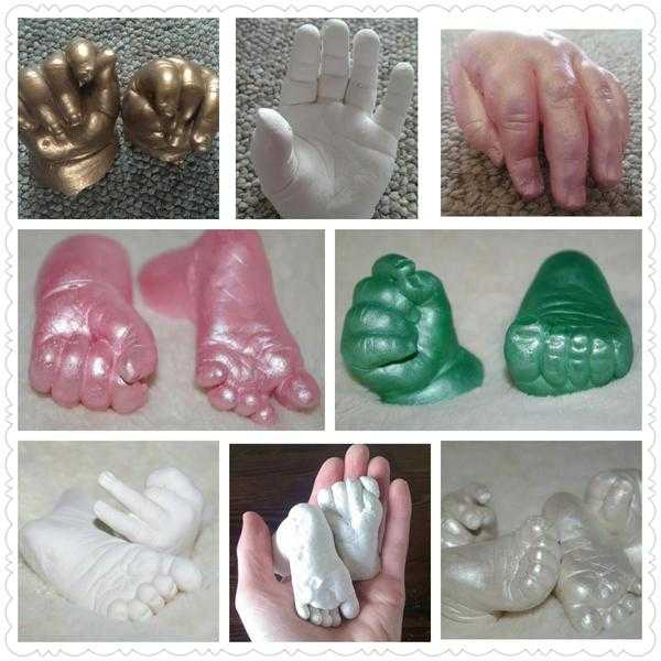 Hand and Foot Castings