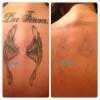 Laser Tattoo Removal  amp other Laser treatments by Anita of Bare Essentials North East