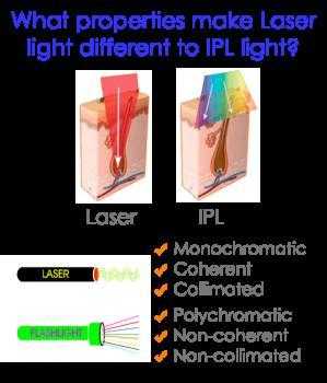 Leicester IPL Training