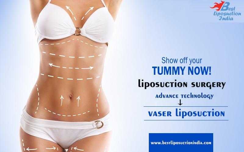 Liposuction Delhi  Liposuction Surgery  Cosmetic Surgeon in INDIA