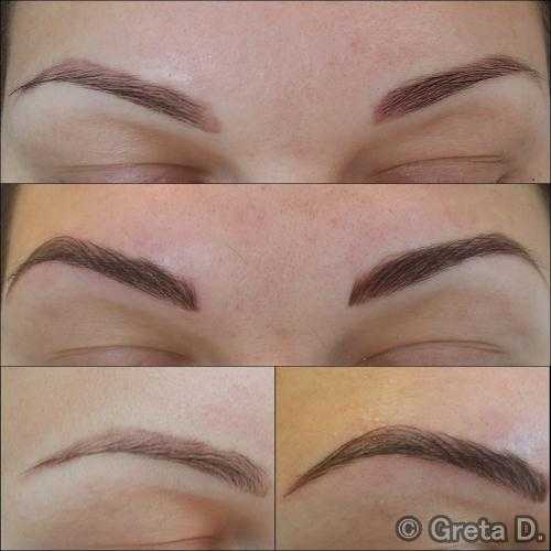 Micropigmentation and Microblading