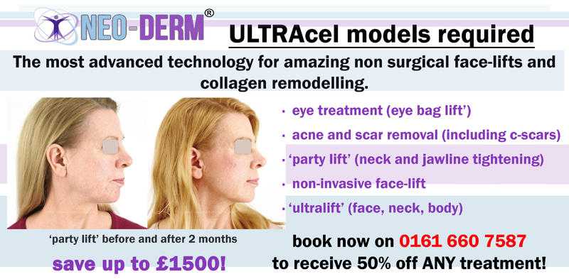 Models wanted for new non surgical skin tightening treatment in Manchester