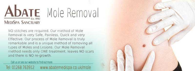 Mole Removal Treatment in Essex.Abate MediSpa is offering 50 Off Treatment for March 2017.