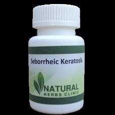 Natural Treatments For Seborrheic Keratosis