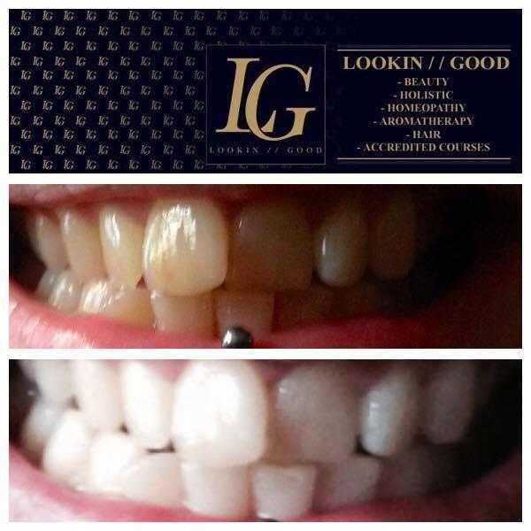 Non peroxide Teeth Whitening ONLY 50