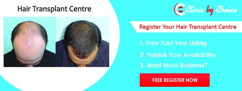 Publish your Clinic Hair Transplant in Bangalore at Free of Cost