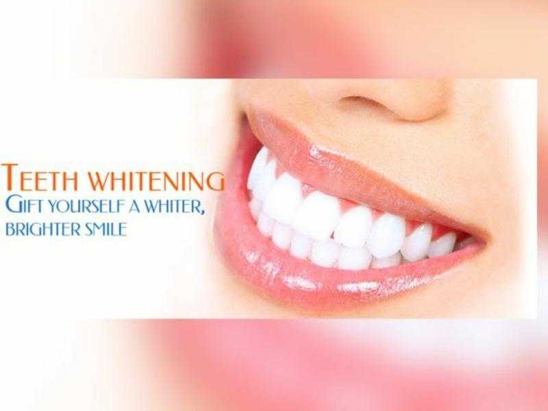 Teeth whitening