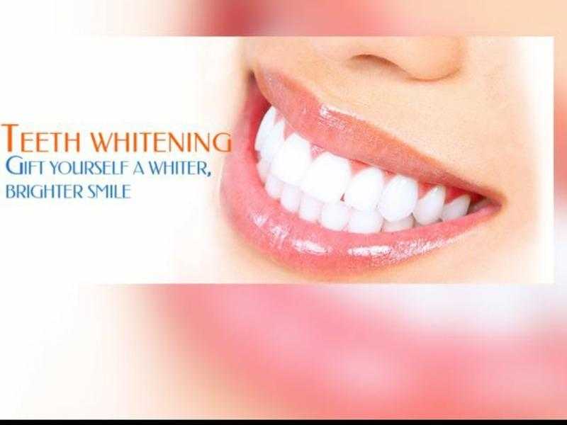 Teeth whitening