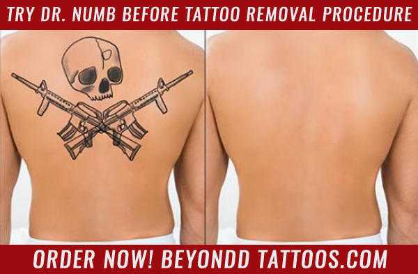 Try Dr. Numb before painful tattoo removal producer