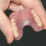 Valplast Flexi Dentures