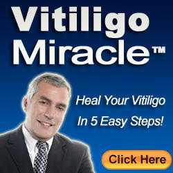 vitiligo miracle review vitiligo miracle scam