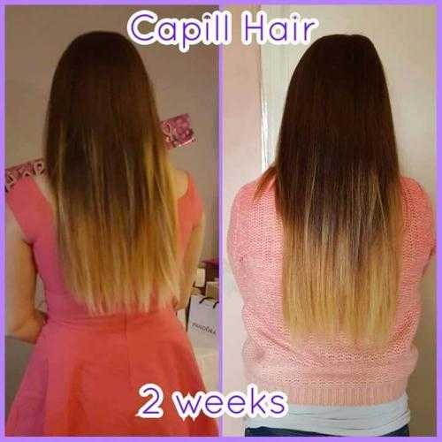 Want longer thicker hair Maybe loose those extra pounds reduce the look of stretch marks