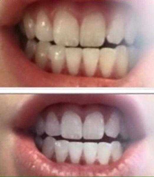 Whitening toothpaste sample